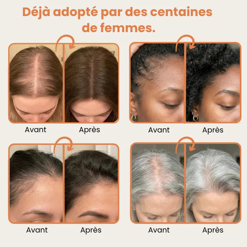 Beauleva — Sérum Coréen Anti-Chute