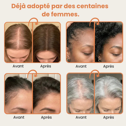 Beauleva — Sérum Coréen Anti-Chute