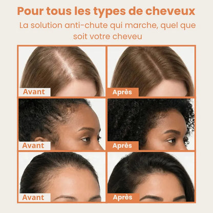 Beauleva — Sérum Coréen Anti-Chute